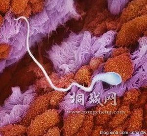 һ�������������ѹ��ҺĤ���ڵ�һ�����ӡ�