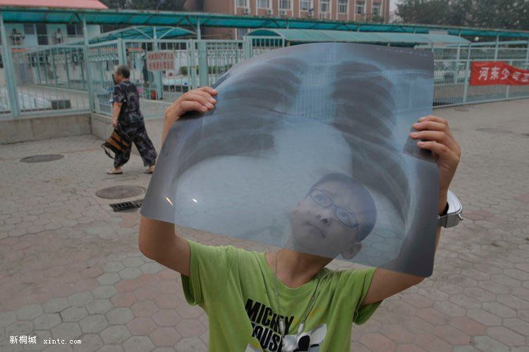 7��22�գ���򣬺������÷Ͼɽ�Ƭ��X��Ƭ��īˮ��۲���ƫʳ��