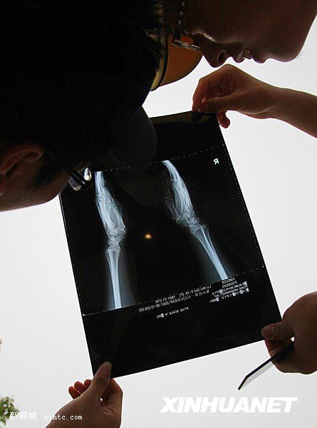 7��22�գ��㽭ʡ��ɽ�ص�����������X��Ƭ�ۿ���ȫʳ��